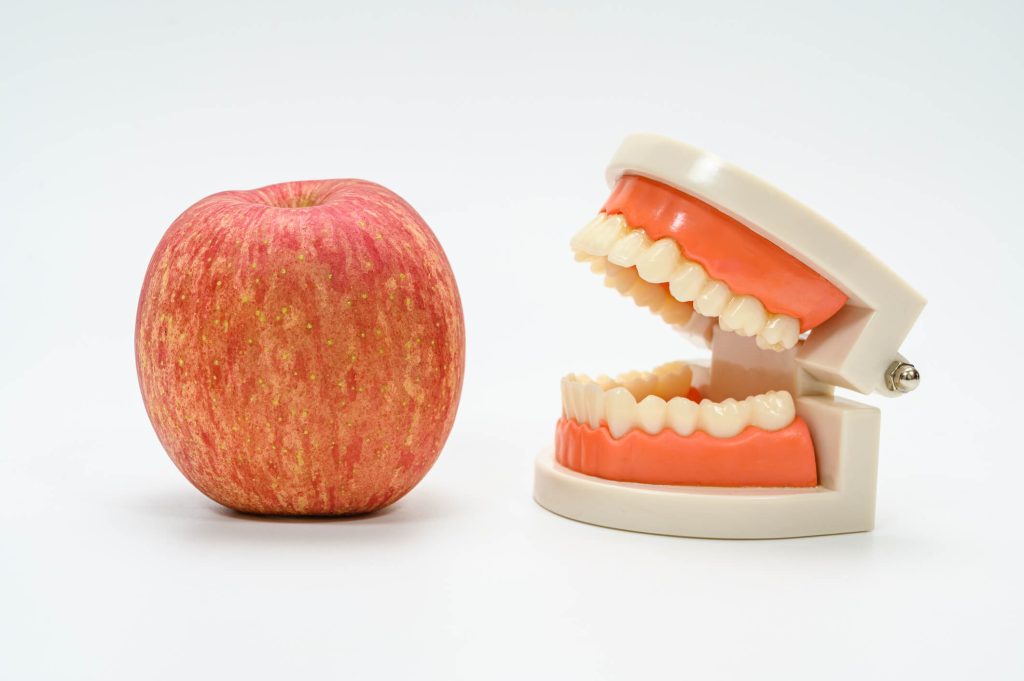 A dental model with a set of artificial teeth is open and positioned next to a fresh red apple on a pure white background.
